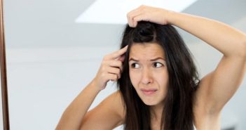 7 Wonder Foods That Can Help You Reduce Dandruff Naturally 7-Wonder-Foods-That-Can-Help-You-Reduce-Dandruff-Naturally-cover
