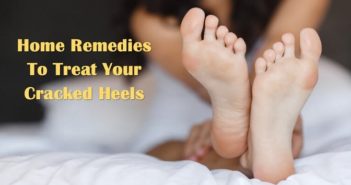 6 Home Remedies for Treating Cracked Heels cracked heels