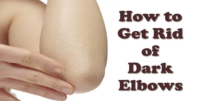Natural Remedies For Dark Spots And Scars Natural Remedies For Dark Spots And Scars