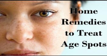 Top 7 Home Remedies To Treat Age Spots Naturally Home Remedies to Treat Age Spots