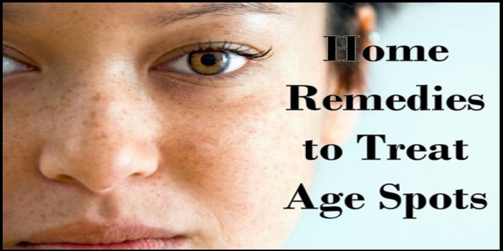 Top 7 Home Remedies To Treat Age Spots Naturally