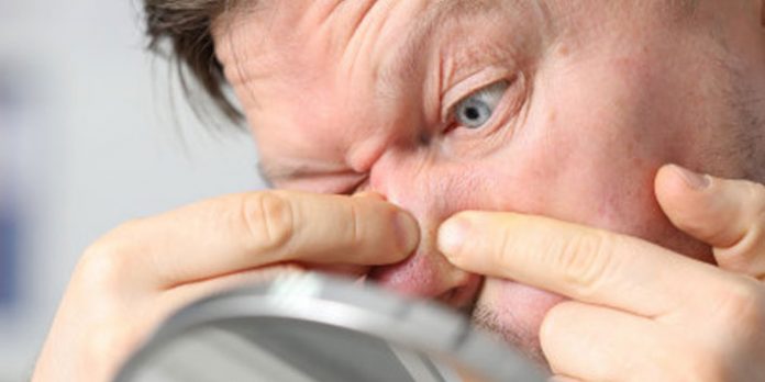 HOW-TO-REMOVE-BLACKHEADS-FROM-NOSE