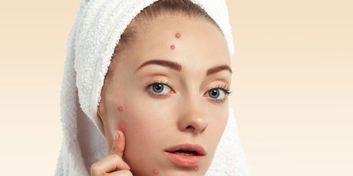 Prevents-the-spread-of-acne-breakouts